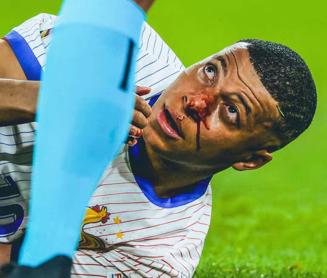 法国后卫表现出色,助球队获得胜利的简单介绍 法国后卫表现出色,助球队获得胜利的简单介绍